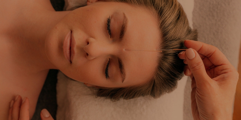 Facial Cosmetic Acupuncture